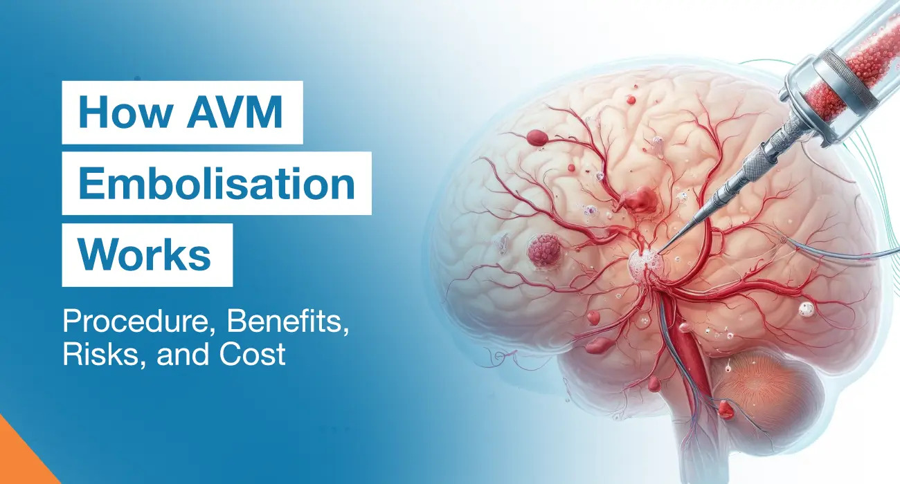 How AVM Embolisation Works: Procedure, Benefits, Risks, and Cost